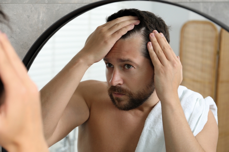 como frenar la caida del cabello