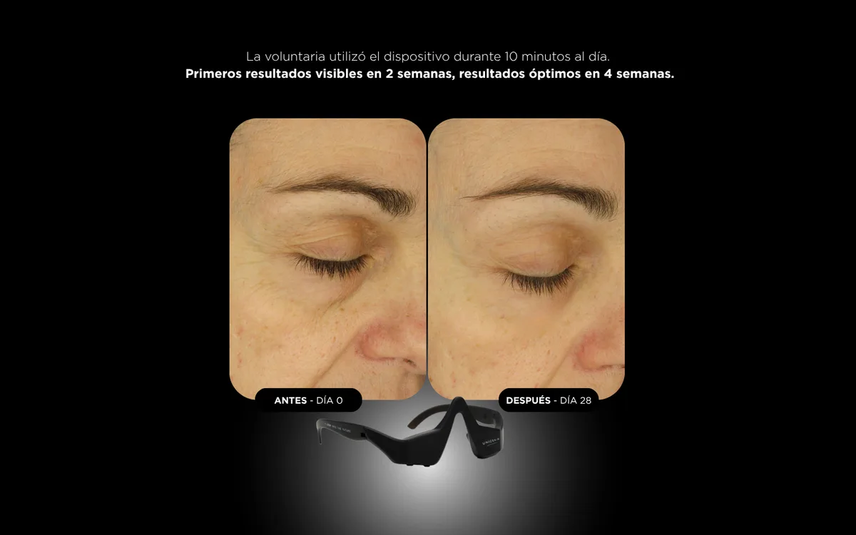 UNICTECH EYE MASK 5.0 de UNICSKIN, detalle 6