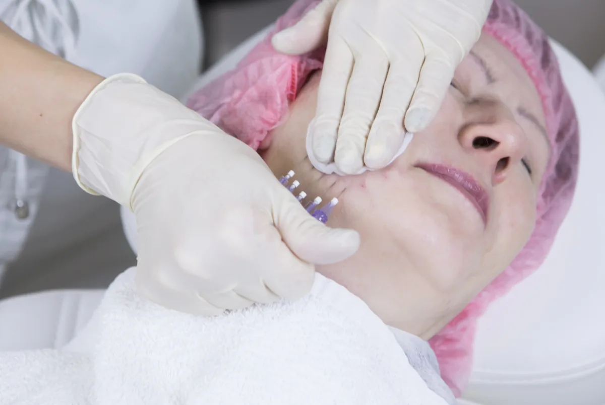 Rostro de mujer durante un tratamiento facial tensor en clínica